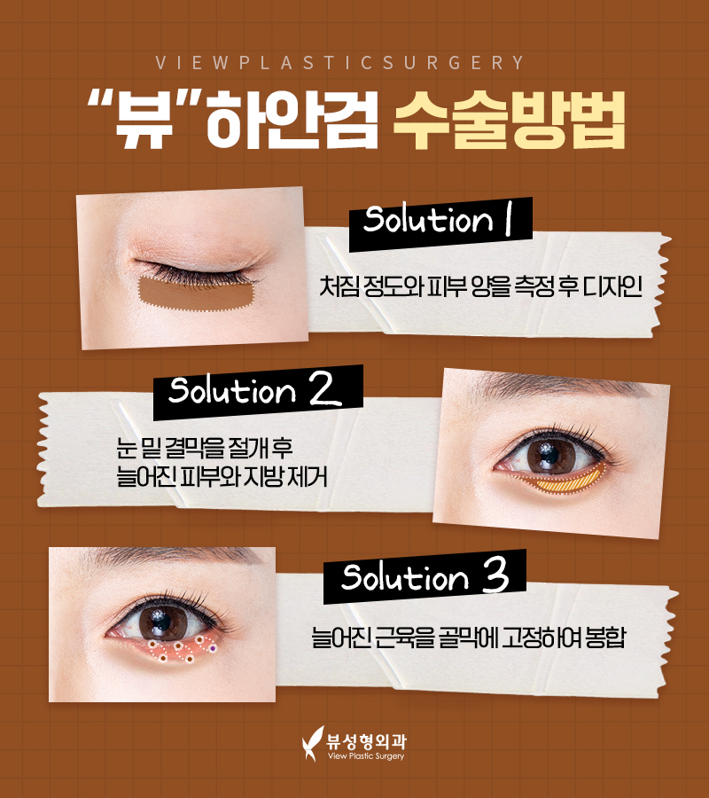 처지고 주름진 피부를 개선하는 다양한 동안성형 방법 관련 이미지 8