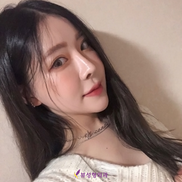 코성형비용 알아봐야 할 부분은? 관련 이미지 7