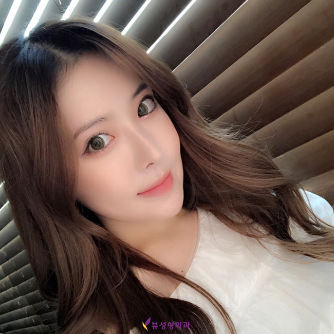 윤곽성형으로 자신감을 얻다! 관련 이미지 2