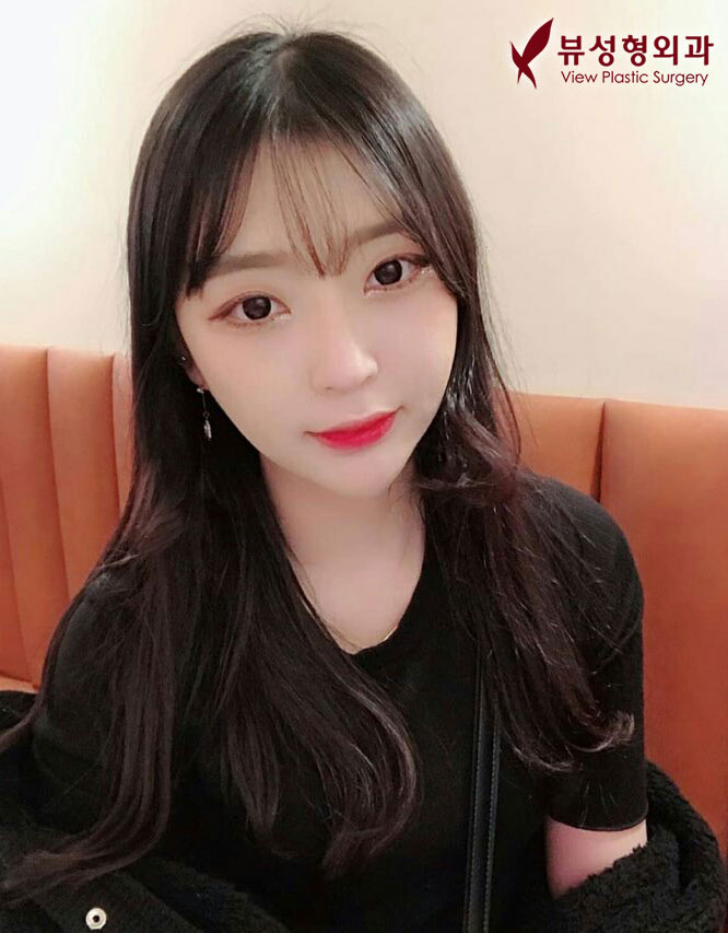 쌍꺼풀수술잘하는병원 알아보고 있다면 관련 이미지 2