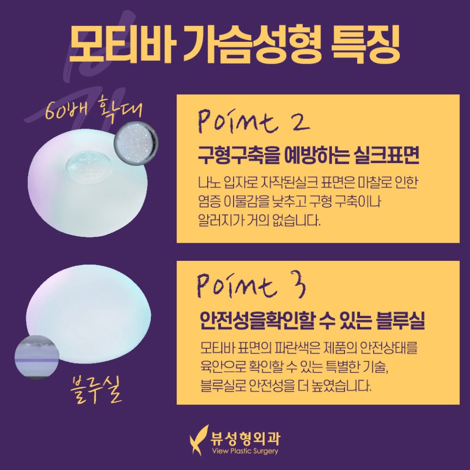 모티바가슴성형후기 꼼꼼히 생각해야 할 점은 관련 이미지 5