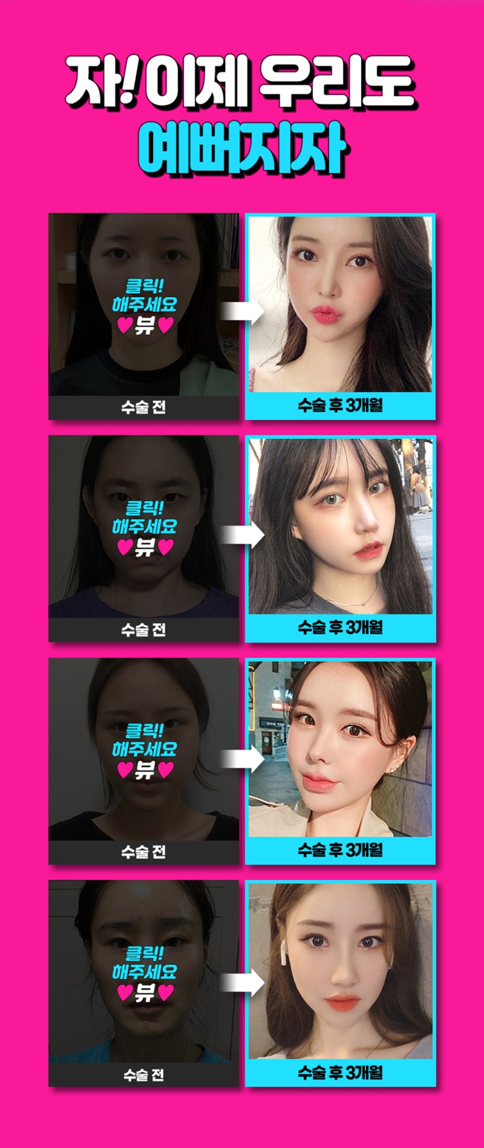 수능이벤트 확인하고 이제 예뻐지자 l 뷰성형외과 관련 이미지 5