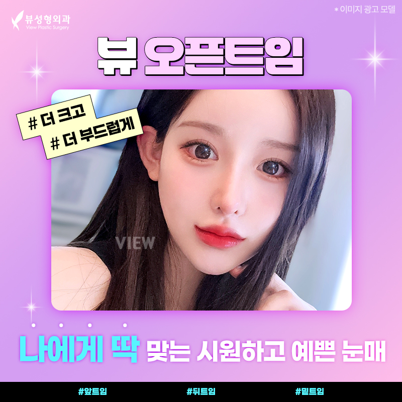 내게 맞는 눈성형 알아보기 관련 이미지 9