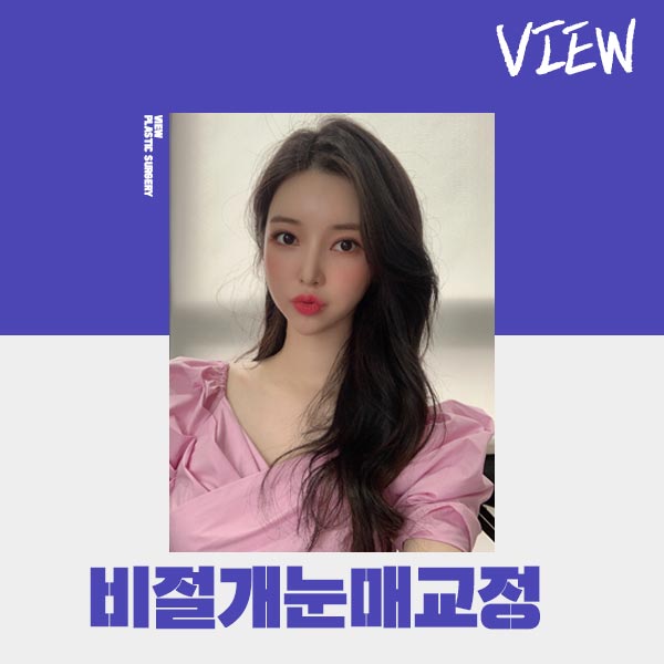 조화로운 비절개눈매교정 하고 싶다면 관련 이미지 4