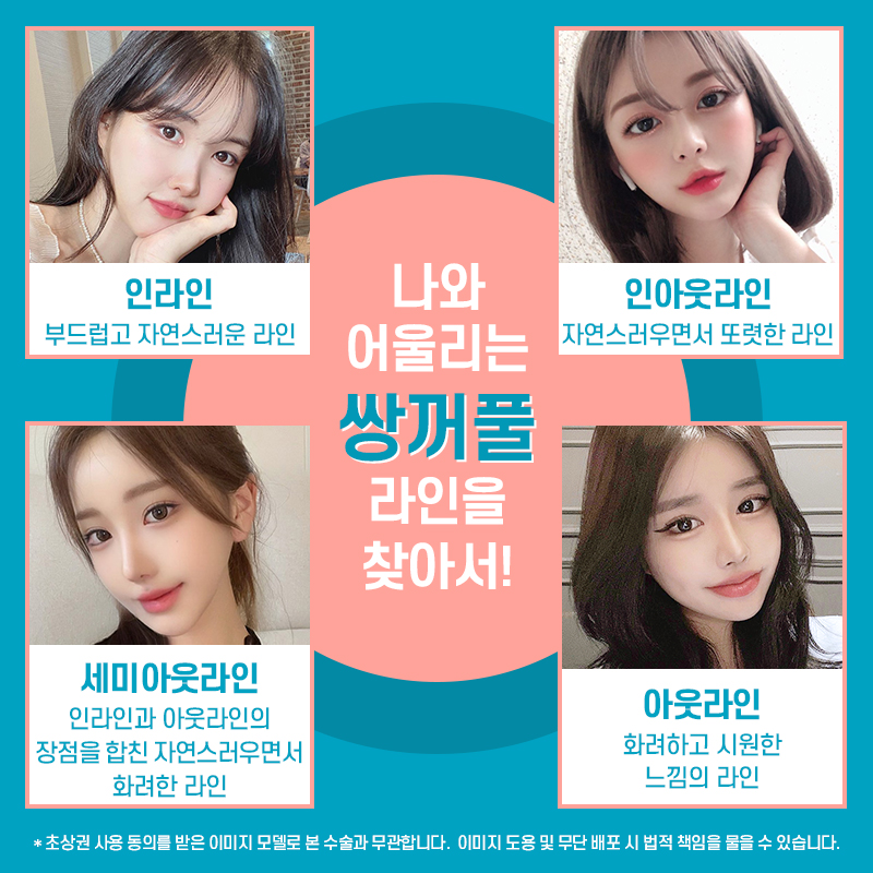 쌍꺼풀재수술비용 높은 난이도이므로 관련 이미지 3