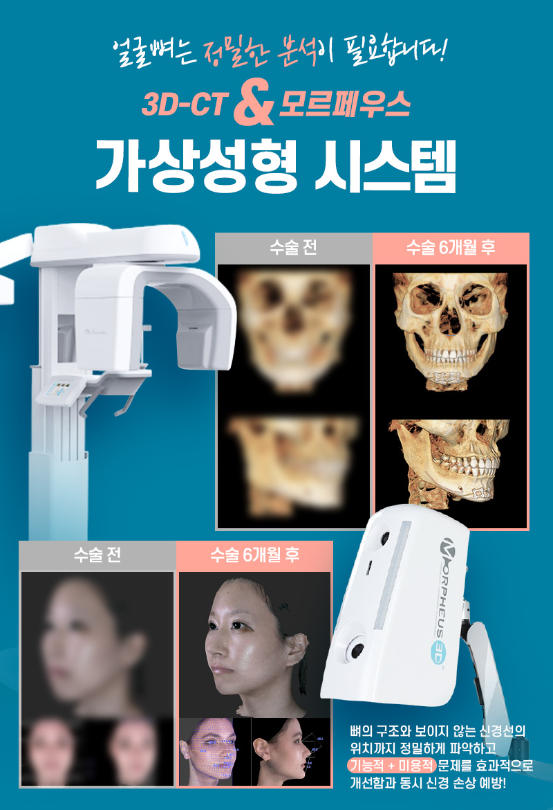 안면윤곽가격과 함께 꼭 따져봐야 할 것은? 관련 이미지 3