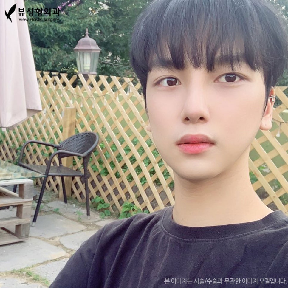 남자눈성형잘하는곳 뷰성형외과 남자콤비매몰이란? 관련 이미지 1