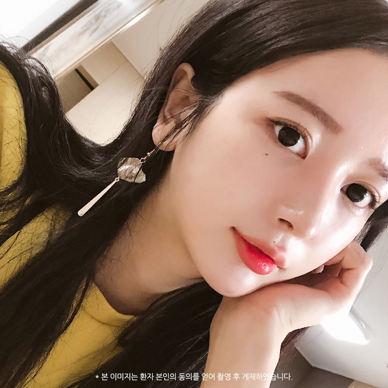 코성형, 개인별 유형에 적합한 수술방법은? 관련 이미지 16