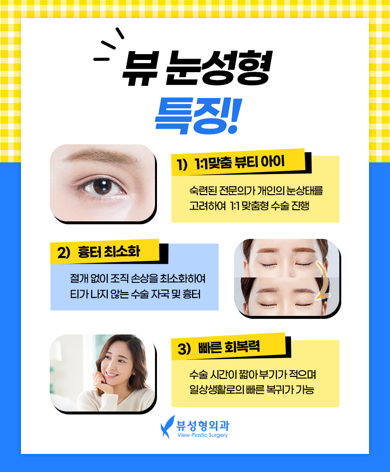 쌍꺼풀매몰법, 뷰에서 빠른 회복까지! 관련 이미지 4