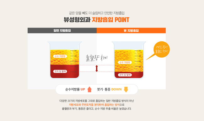 &hearts; 뷰성형외과 지방흡입 프로모션 OPEN&hearts; 관련 이미지 3