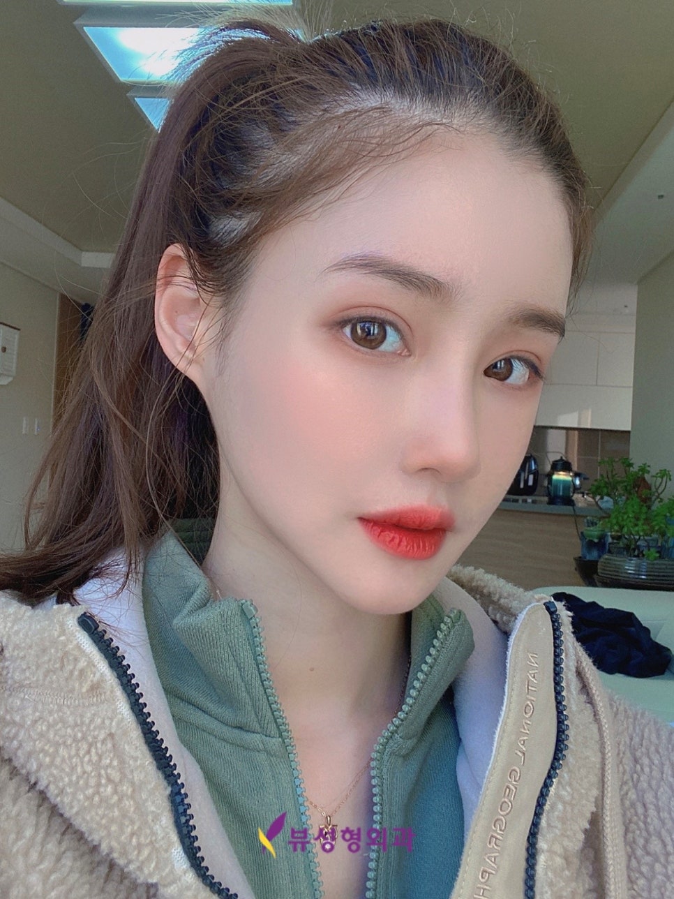 턱 끝축소술 잘하는 뷰성형외과, V라인을 원한다면 관련 이미지 5