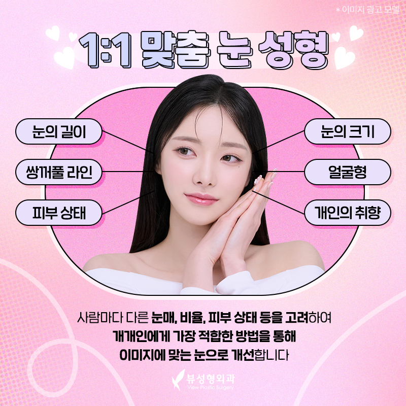 내게 맞는 눈성형 알아보기 관련 이미지 3