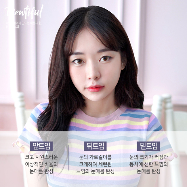 강남트임성형은 뷰성형외과가 찐이다★ 관련 이미지 3