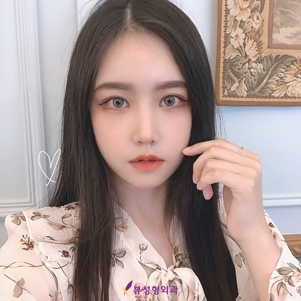 쌍꺼풀수술잘하는병원 뷰성형외과, 다 이유가 있찌🧡 관련 이미지 2
