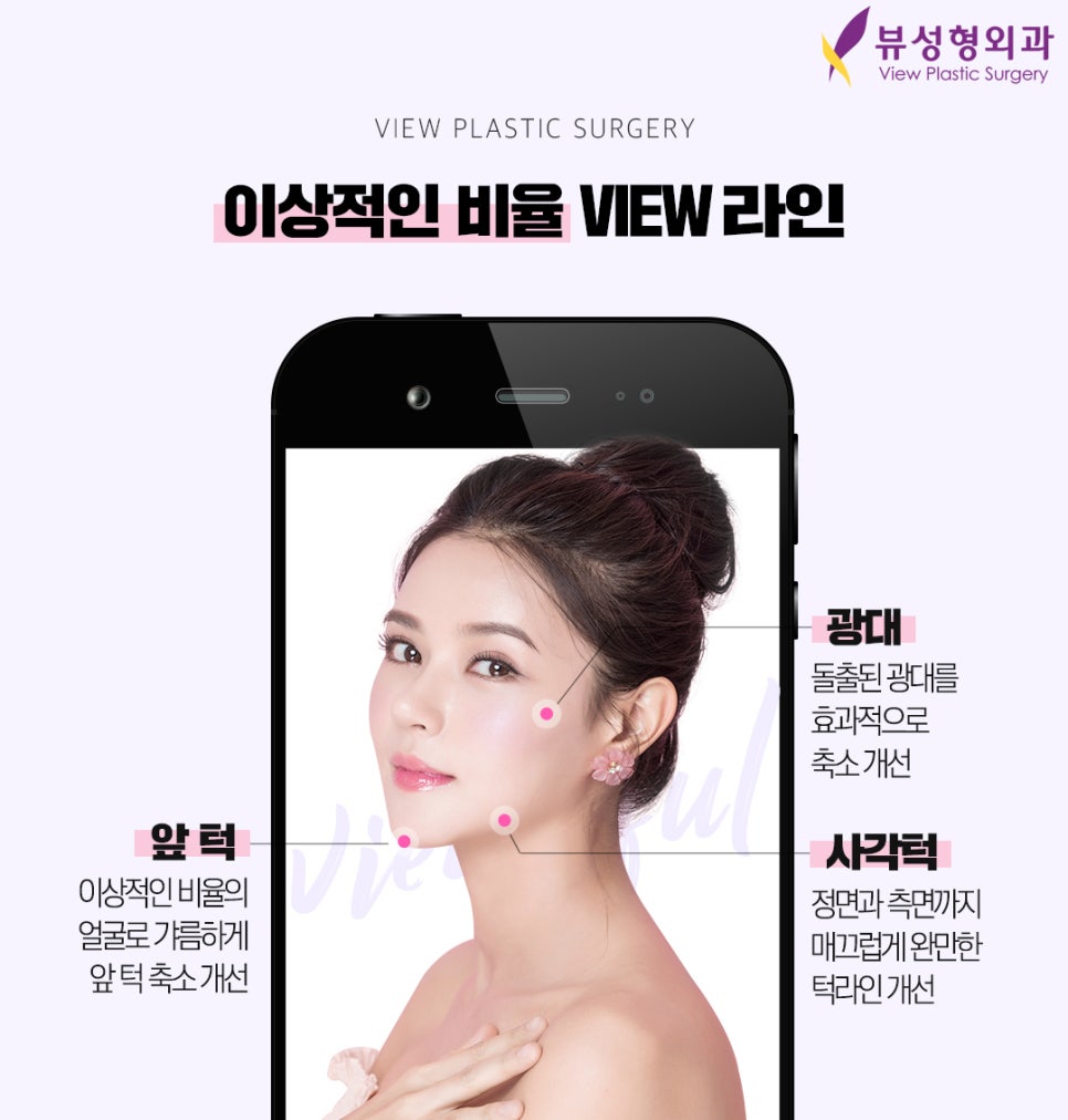 안면윤곽후기, 붓기는 얼마나 갈까? 관련 이미지 2