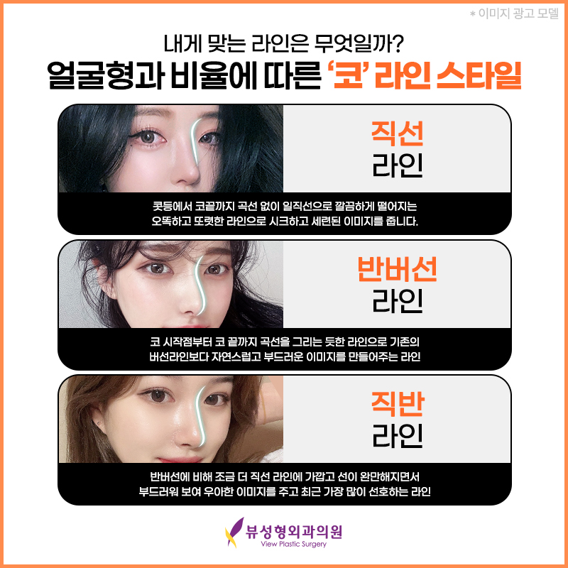 코성형, 개인별 유형에 적합한 수술방법은? 관련 이미지 2