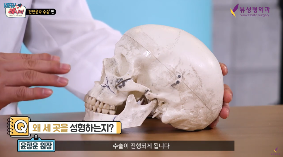 남자안면윤곽 새로운 변화를 원한다면 관련 이미지 5