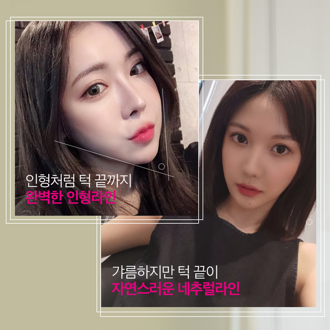 얼굴형도 선택이 가능해? 관련 이미지 3