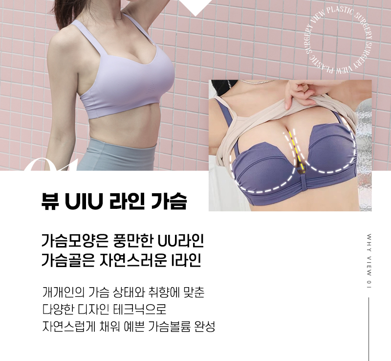 자연스러운 모양과 볼륨, 가슴수술전후가 궁금하다면? 관련 이미지 6