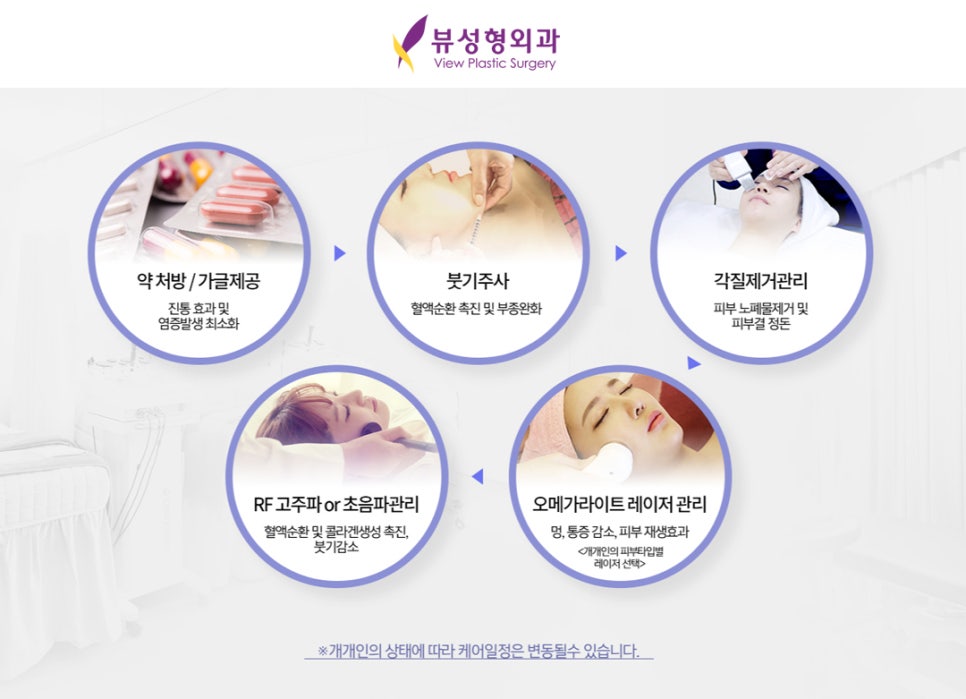 안면윤곽재수술 후기 | 발품 꿀팁 관련 이미지 11
