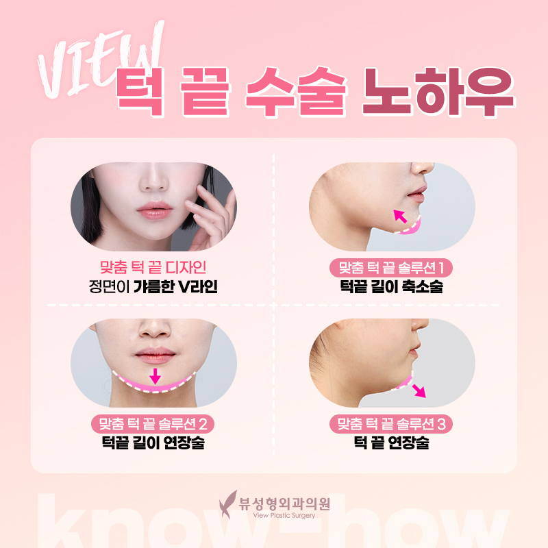 안면윤곽가격 정확히 알아보려면? 관련 이미지 8