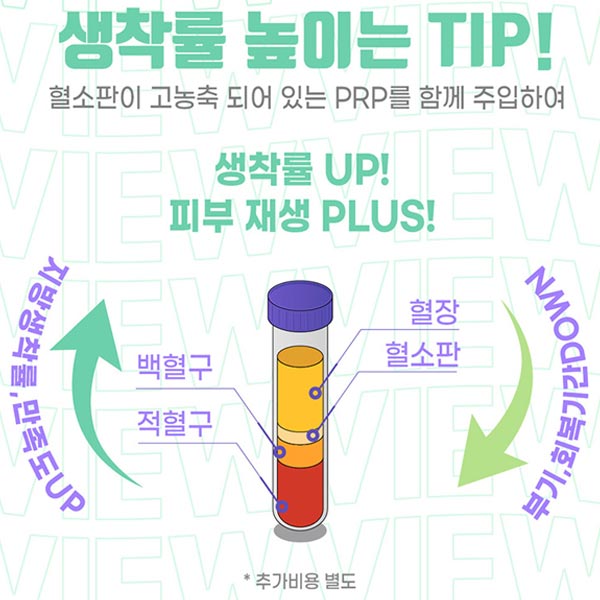 팔자주름지방이식 으로 젊어지자! 관련 이미지 9