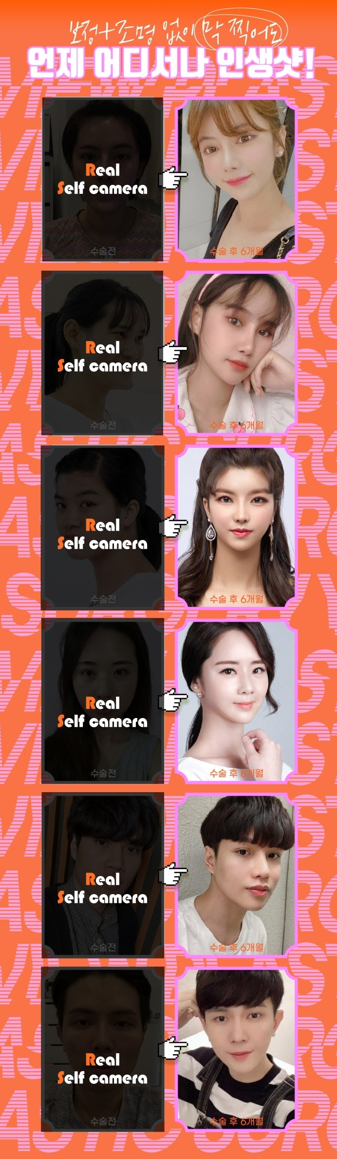 예뻐지는 수술? 양악수술의 올바른 정보 관련 이미지 3