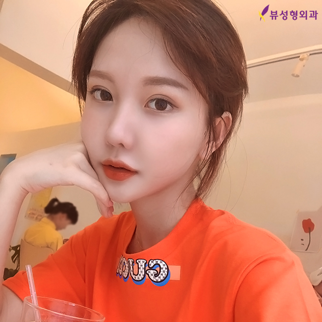 하이본 광대축소로 어느 각도에서나 갸름하게♥ 관련 이미지 5