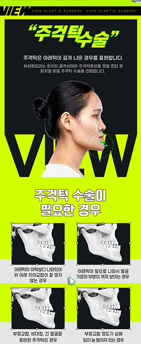 긴얼굴성형 미용과 기능 모두 잡길 원한다면 관련 이미지 2