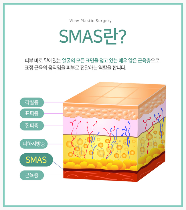 젊음의비결! 부분거상술 상안검/하안검 선택하세요 관련 이미지 3