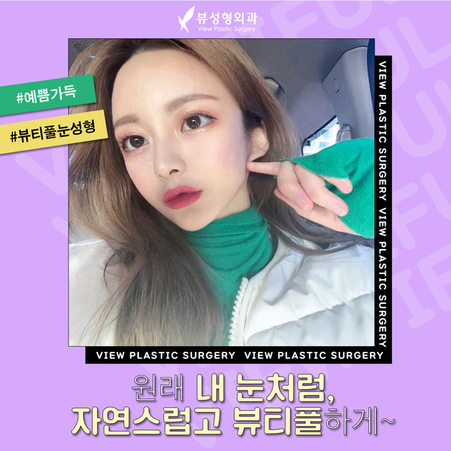 매몰법잘하는곳 뷰성형외과 콤비매몰이라면 관련 이미지 2