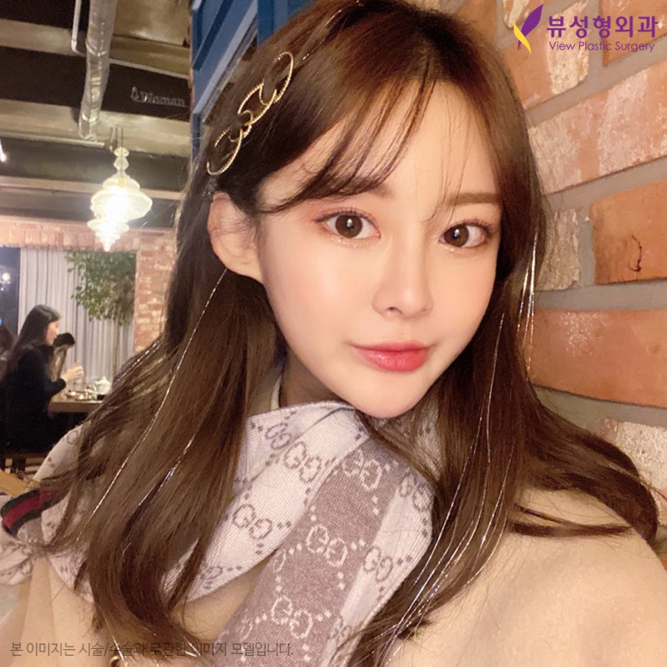 안면윤곽후기, 붓기는 얼마나 갈까? 관련 이미지 1