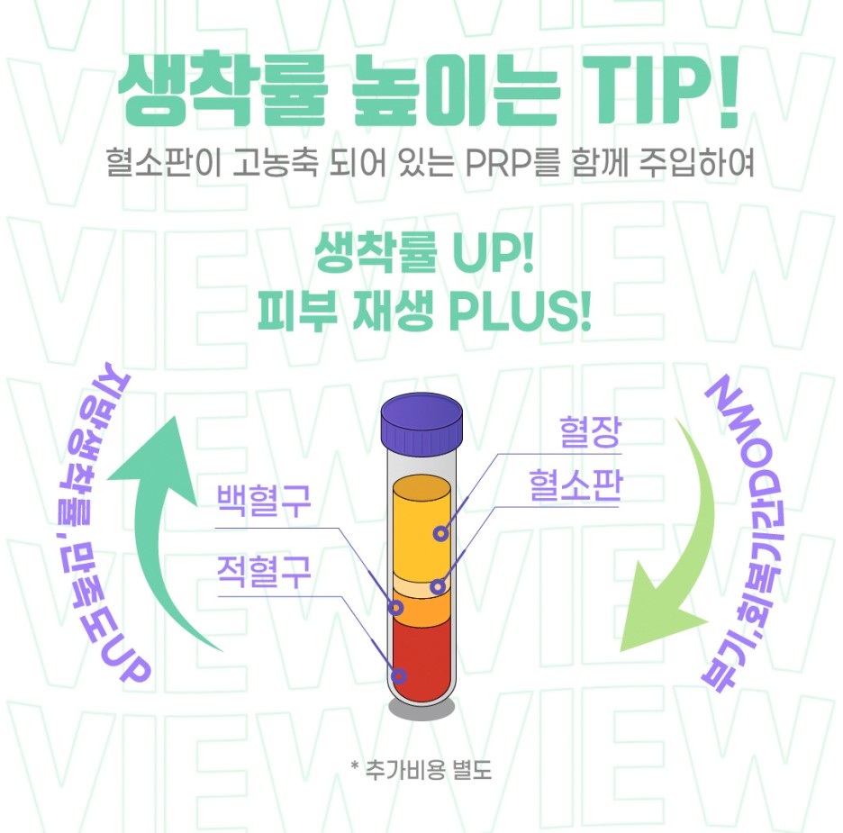 밋밋한 얼굴을 볼륨감 있게 입체적으로 개선하는 지방이식 관련 이미지 8