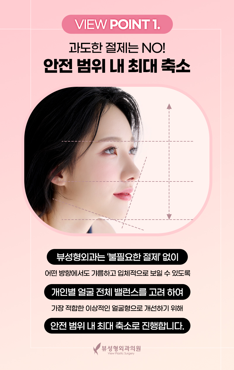 안면윤곽가격 정확히 알아보려면? 관련 이미지 10