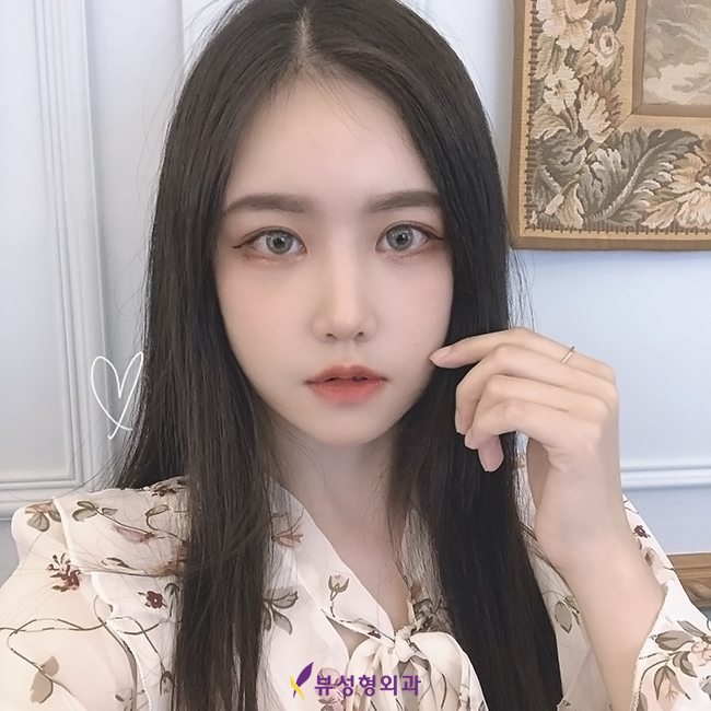 쌍꺼풀매몰법 선명하고 또렷한 눈매★ 관련 이미지 3