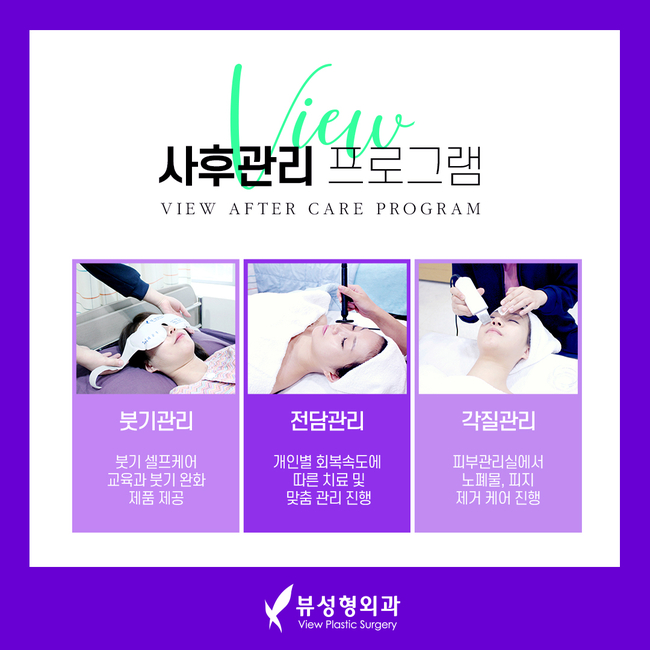 낮은코수술 뷰성형외과 조화롭고 오똑하게 관련 이미지 8
