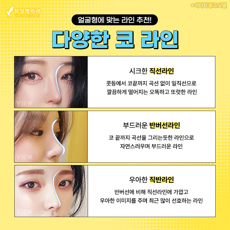 코성형, 개인별 유형에 적합한 수술방법은? 관련 이미지 3