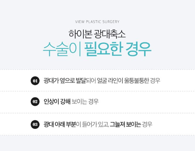 옆광대축소 작은얼굴 바란다면 관련 이미지 4