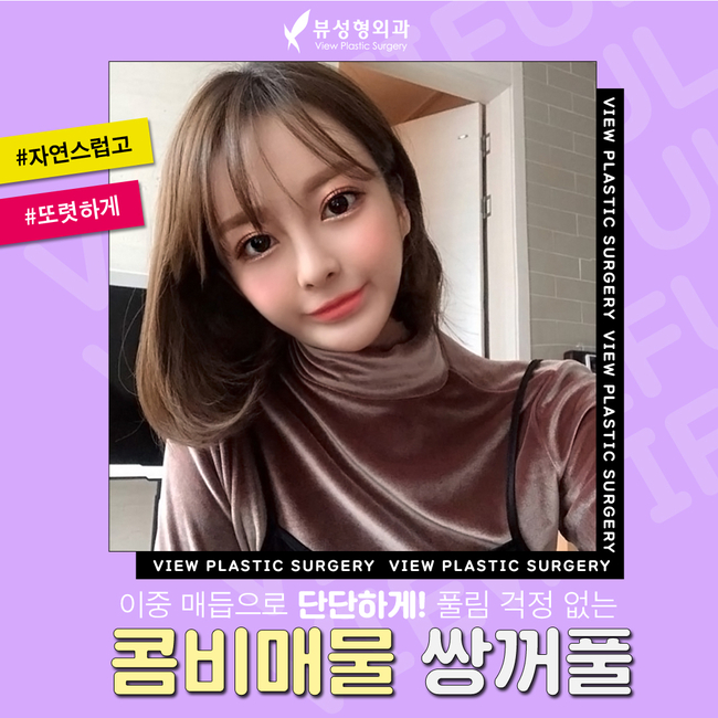 매몰법잘하는곳 뷰성형외과 콤비매몰이라면 관련 이미지 12