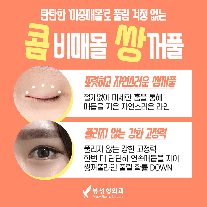 나만의 눈성형을 위한 수술방법 알아보기 관련 이미지 4
