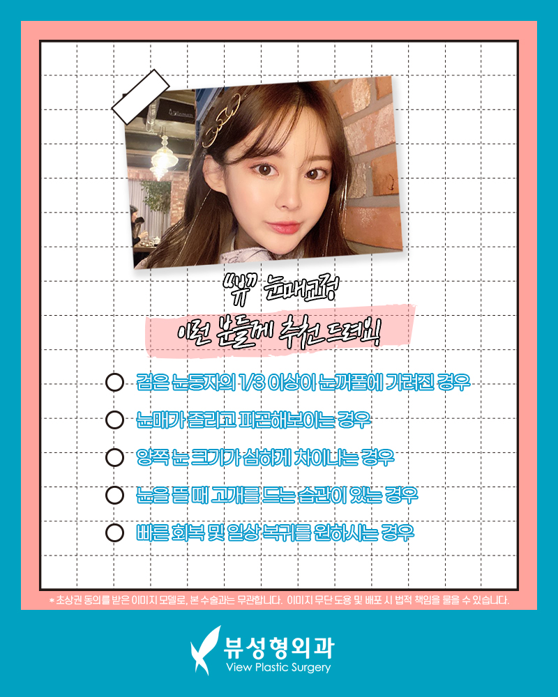 눈성형외과 중요한 점부터 관련 이미지 2