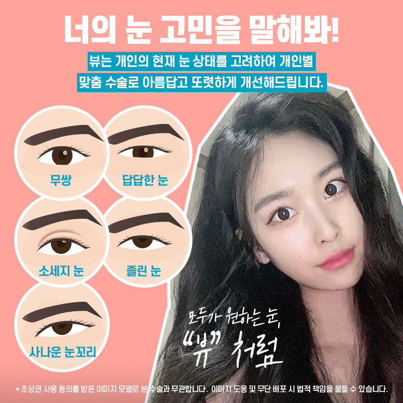 눈성형외과 중요한 점부터 관련 이미지 3