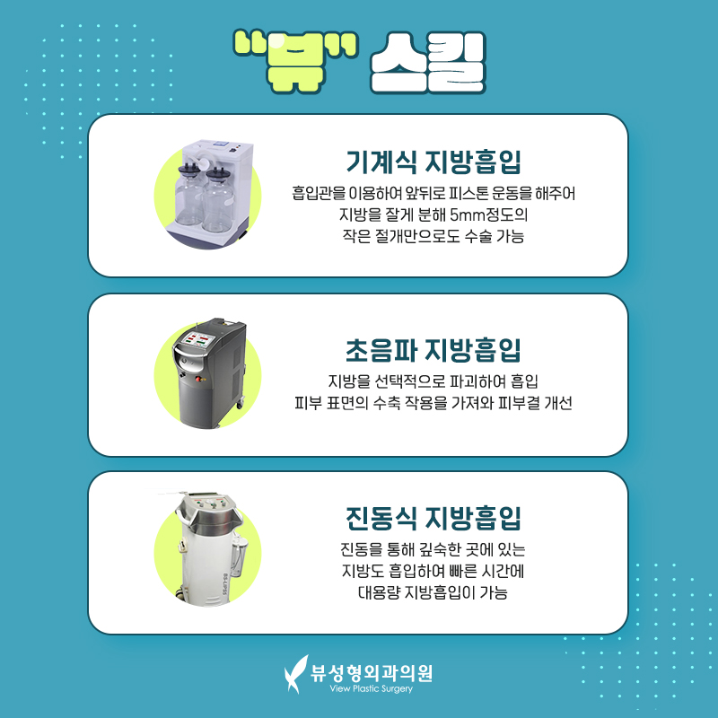 뷰성형외과에서 팔뚝지방흡입하고 직각어깨 됐어요! 관련 이미지 4