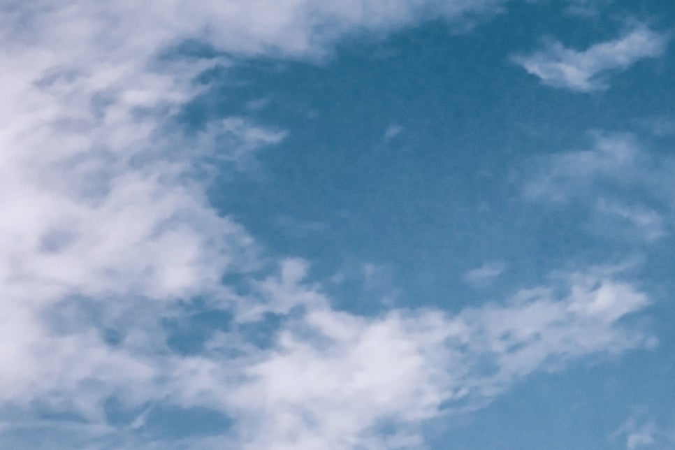 안면윤곽후기 뼈 상태를 위주로 관련 이미지 18