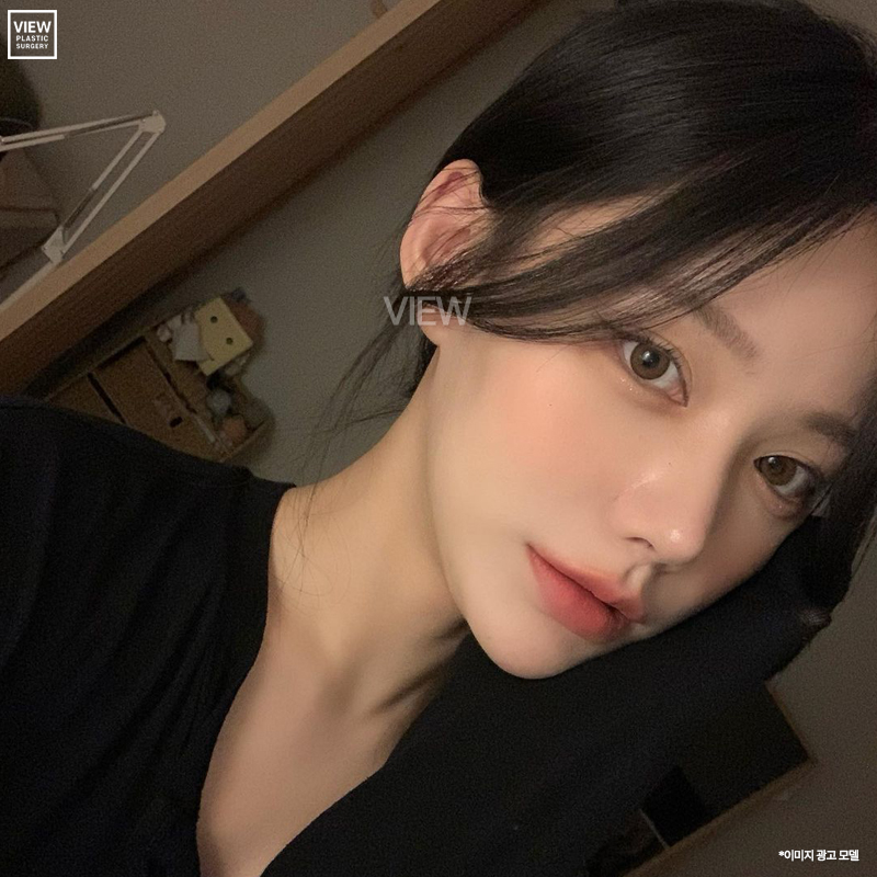 이런 질문까지? 알짜배기 안면윤곽 질문 모음. Zip 관련 이미지 3