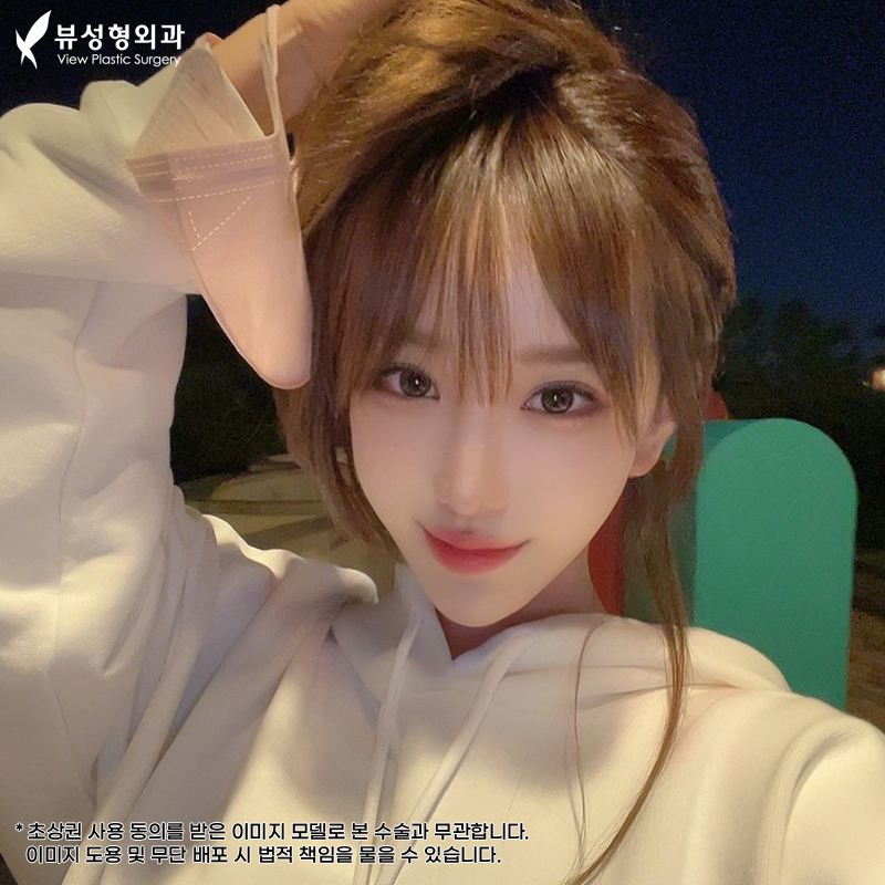 쌍수잘하는곳, 뷰성형외과 관련 이미지 7