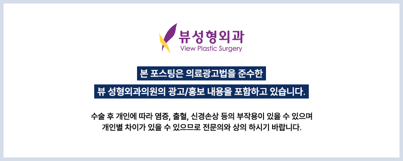 내게 맞는 눈성형 알아보기 관련 이미지 20