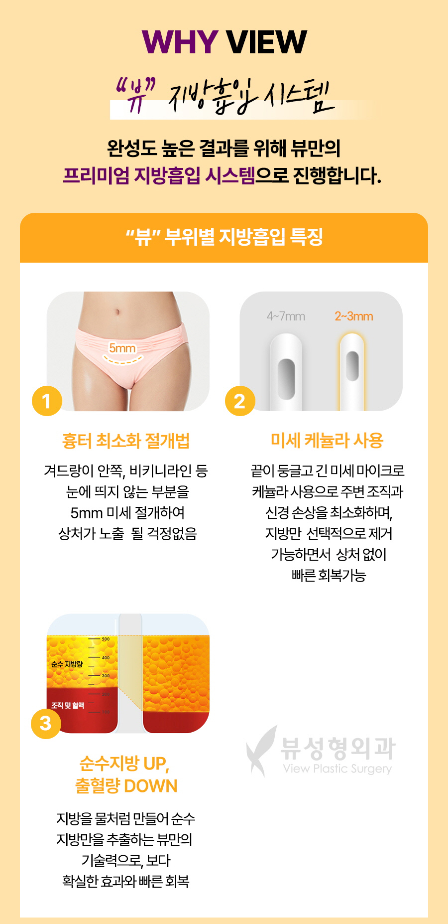 단기간내 눈에 띄는 지방 감량 방법, 지방흡입 관련 이미지 5