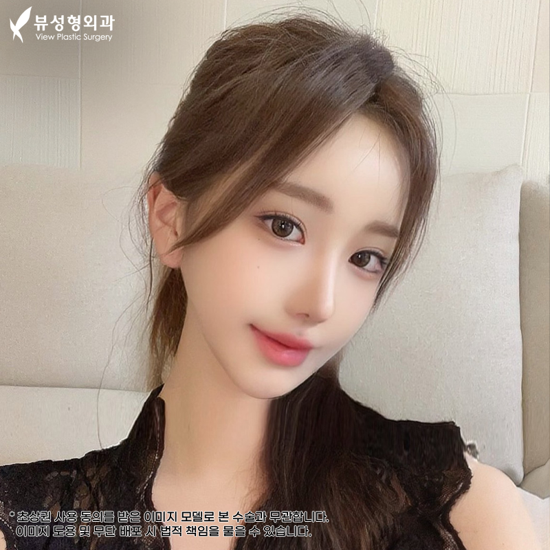 쌍수잘하는곳, 뷰성형외과 관련 이미지 1