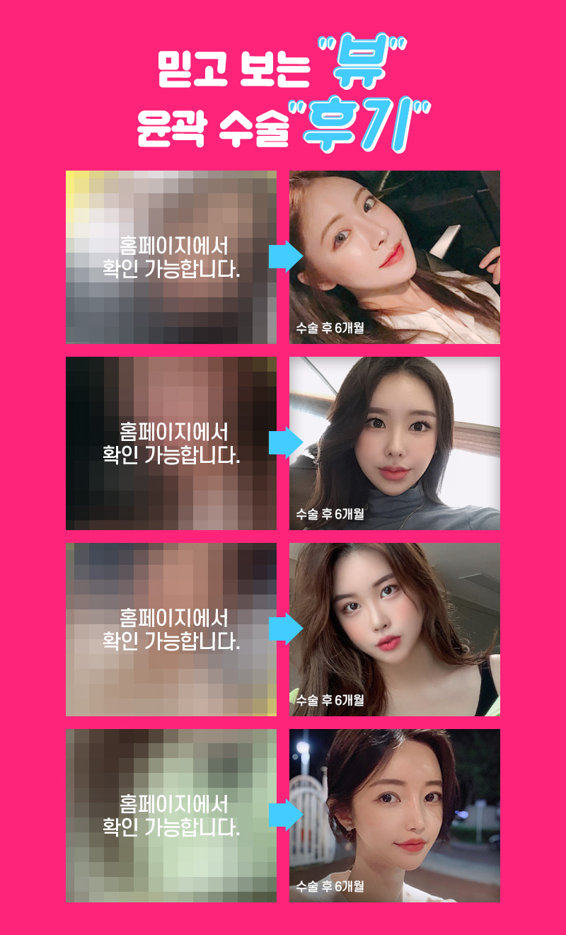 안면윤곽볼처짐, 줄일 수 있는 방법은 관련 이미지 8